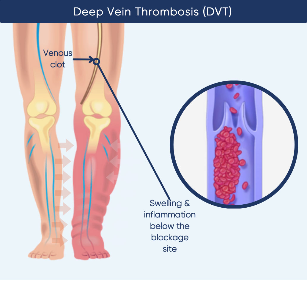 Lower Extremity Deep Venous Anatomy