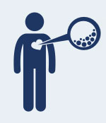 High cholesterol can increase the risk of stroke