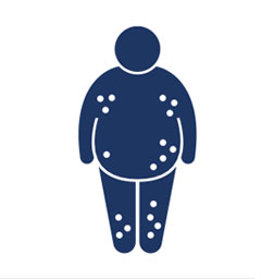 Risks of venous surgery