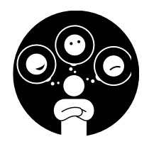 Emotional preparation is part of preparing for kidney transplant surgery